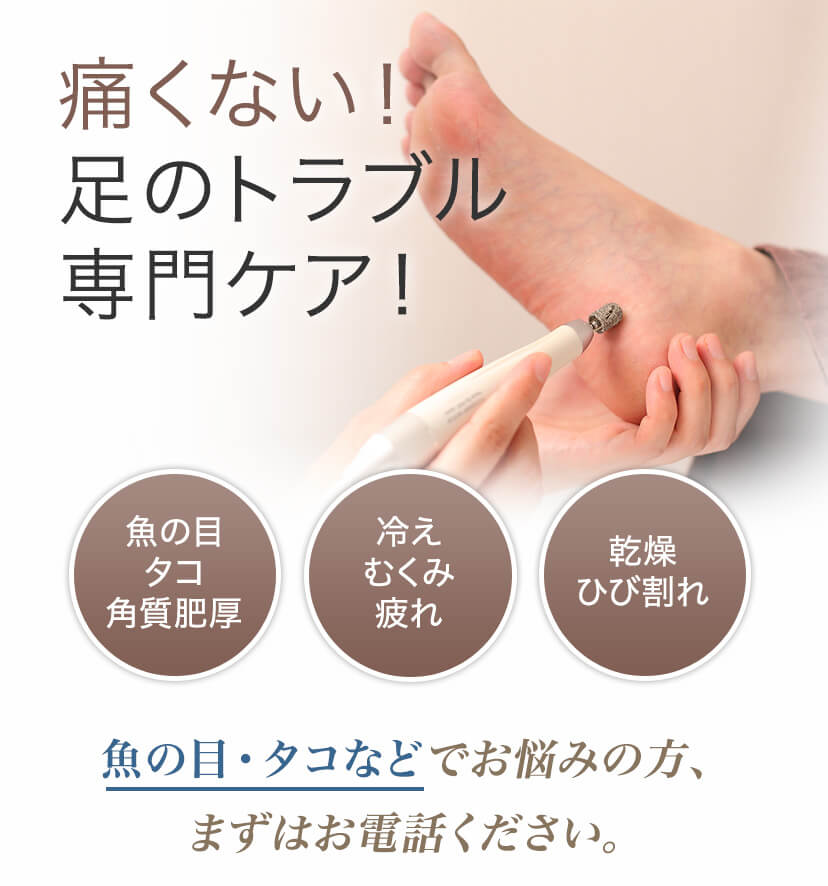 痛くない！足のトラブル専門ケア！魚の目・タコなどでお悩めの方、まずはお電話ください。